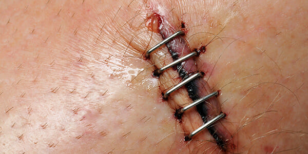 A band-aid is not enough to improve the long-term wellbeing of the profession