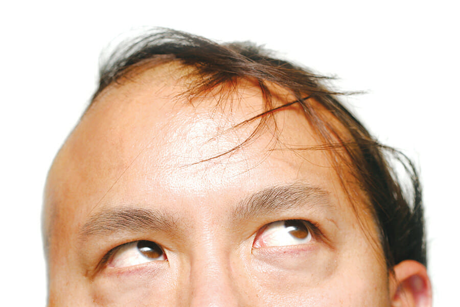 Final word: Losing hair, gaining perspective